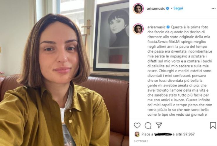 arisa confessione della chirurgia su instagram