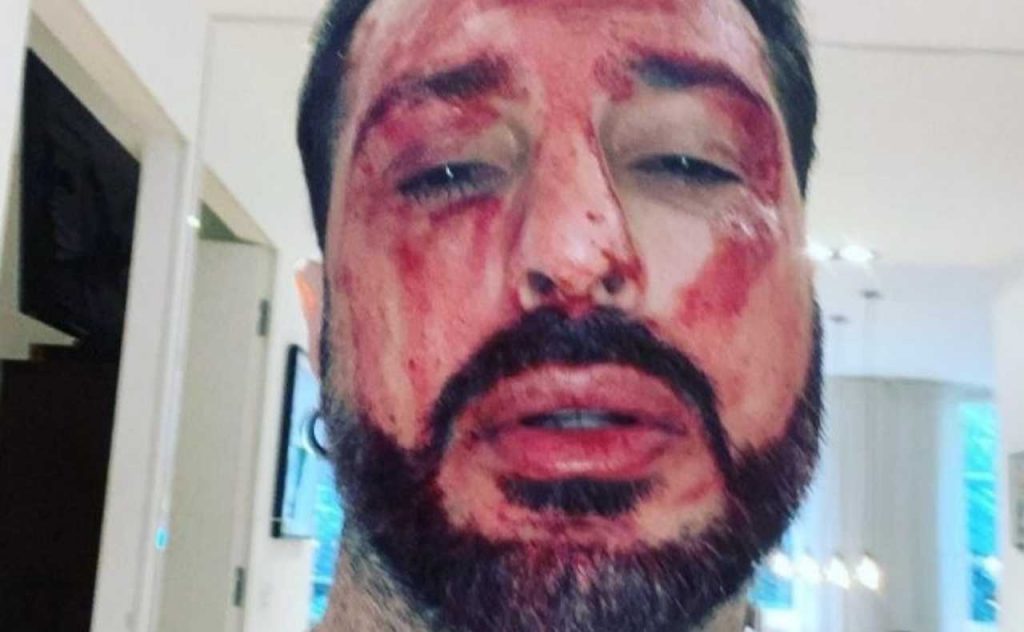 Fabrizio Corona minaccia il suicidio, si taglia i polsi e pubblica tutto su Instagram: il video choc