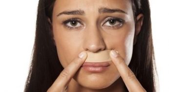 Zona baffi scura: i rimedi infallibili per eliminarla