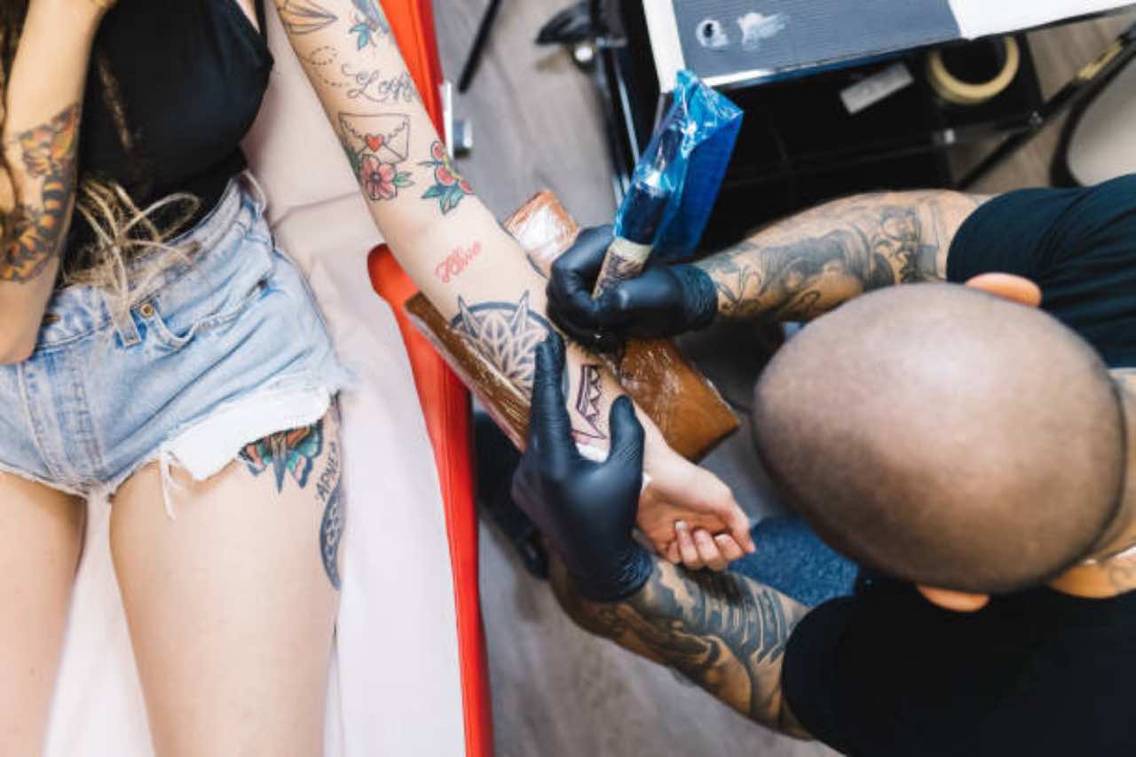 Come eliminare un tatuaggio
